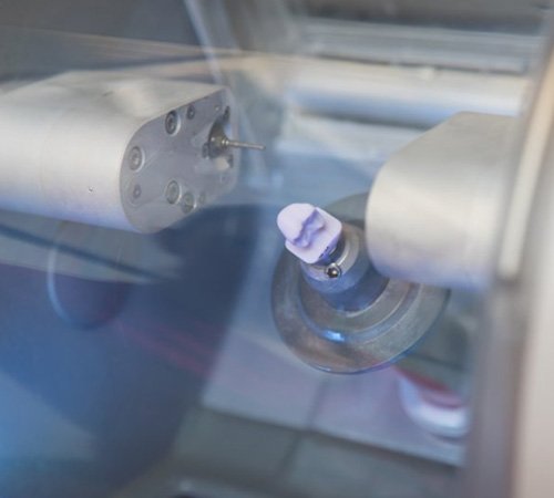 CEREC Same-Day Dental Crown Process