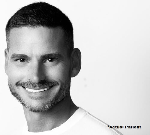 Patient sharing beautiful smile after veneer restoration