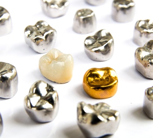 Dental Crowns In Houston TX