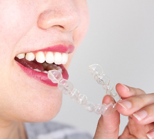 woman taking out Invisalign in Houston